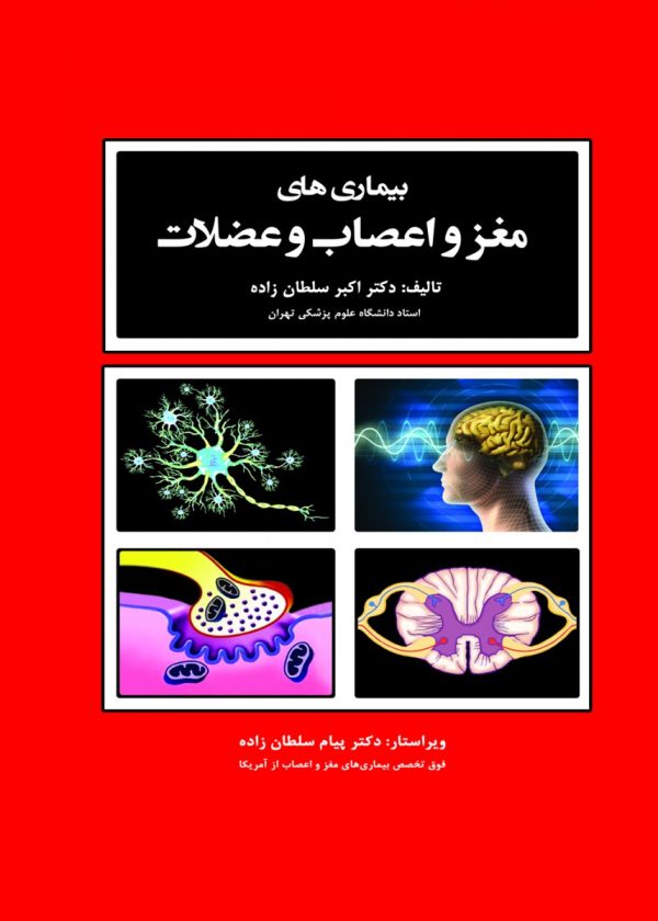 بیماری های مغز و اعصاب و عضلات سلطان زاده