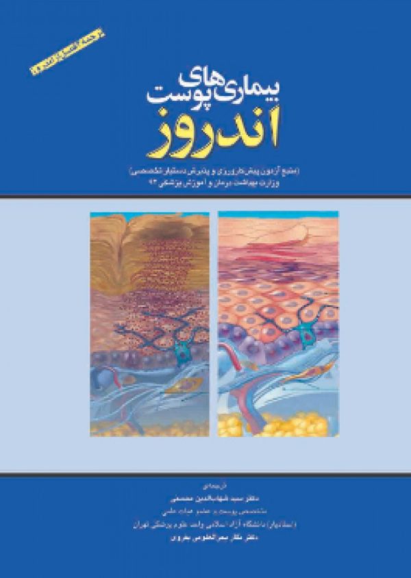 بيماريهای پوست اندروز