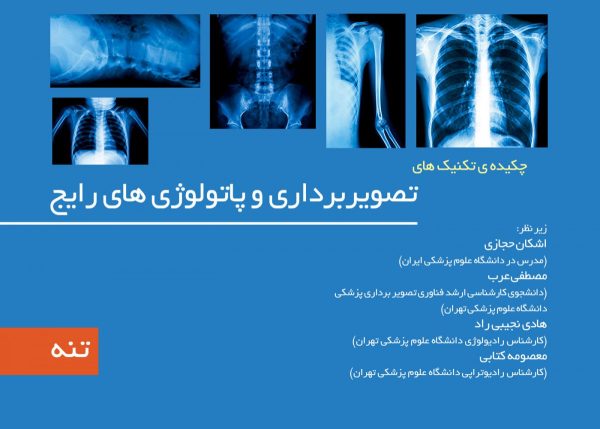 چکیده تکینک های تصویربرداری و پاتولوژی رایج جلد۳ - تنه