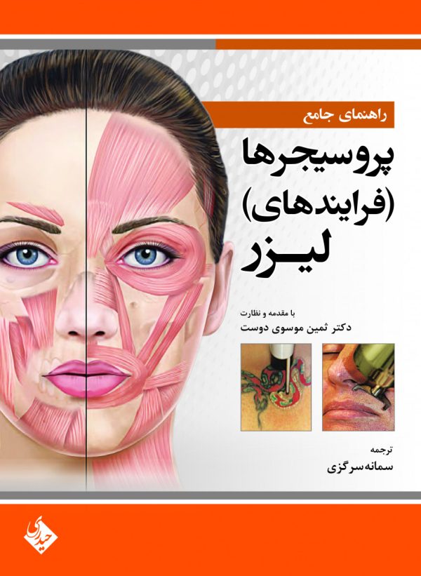 راهنمای جامع پروسیجرها (فرایندهای) لیزر
