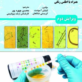 آنالیز ادرار و مایعات بدن (گراف)