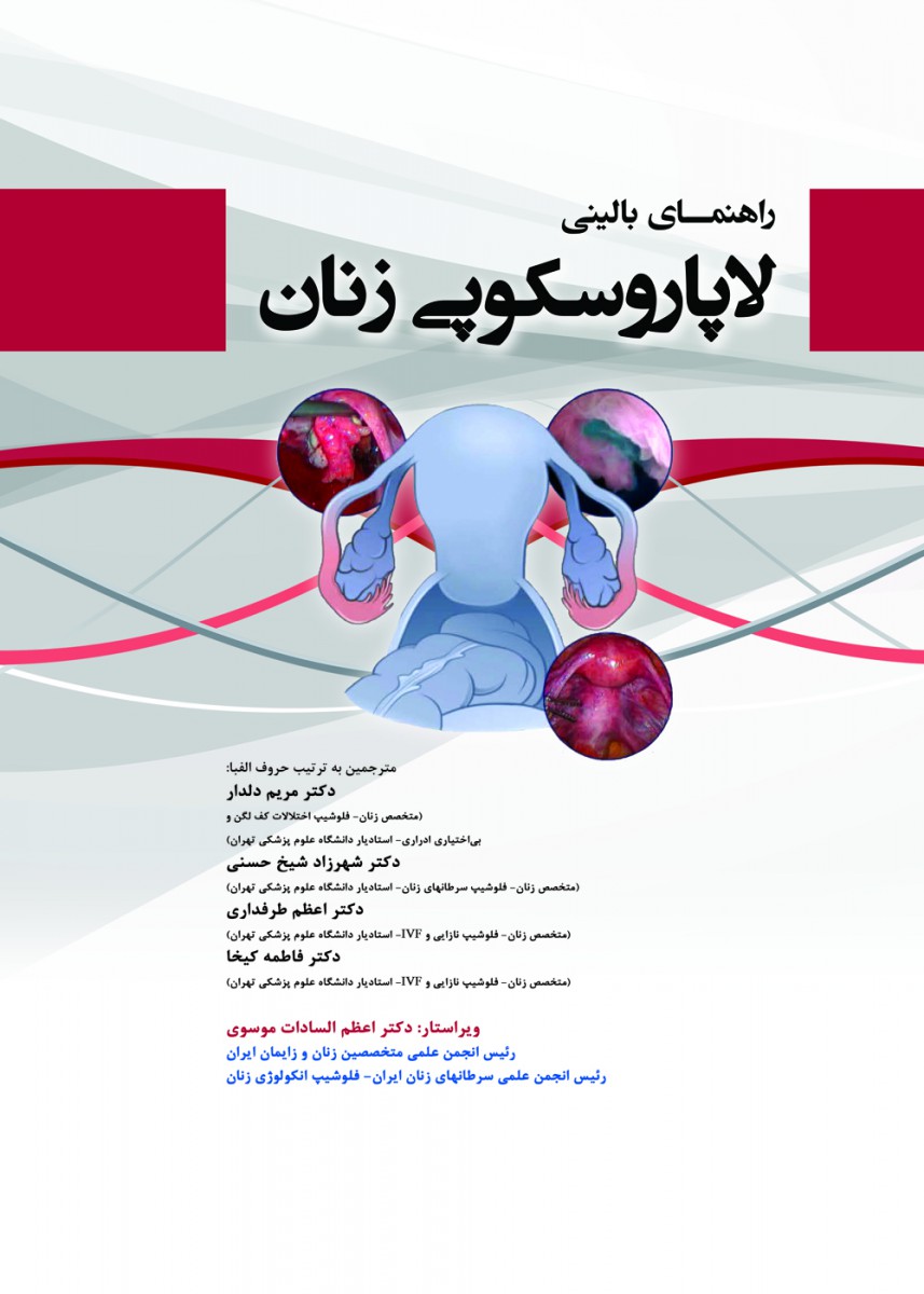 راهنمای جامع لاپاروسکوپی زنان
